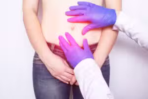 The Hernia You’ve Never Heard of — the Parastomal Hernia 1 iStock 1174209657