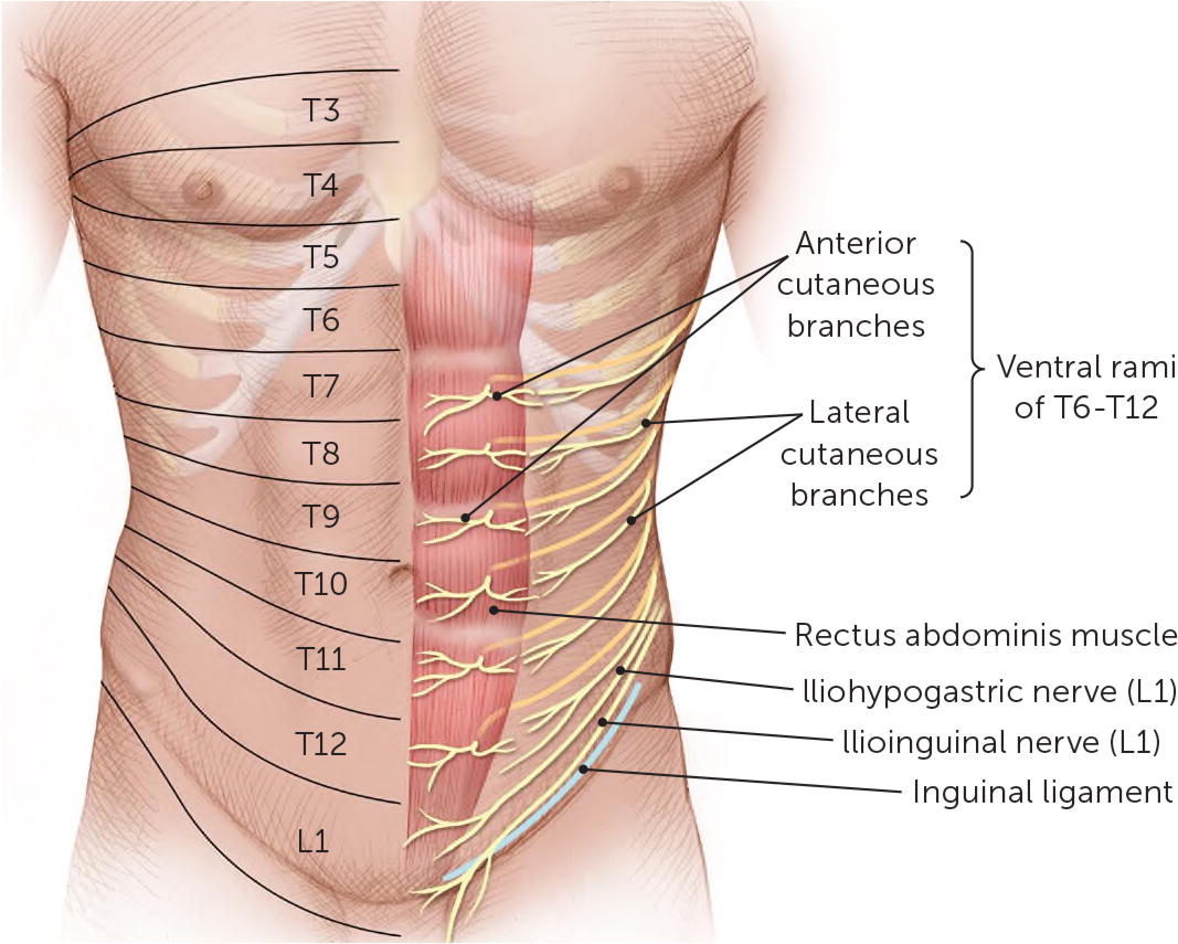 Anterior Cutaneous Nerve Entrapment Syndrome NYC ACNES Treatment