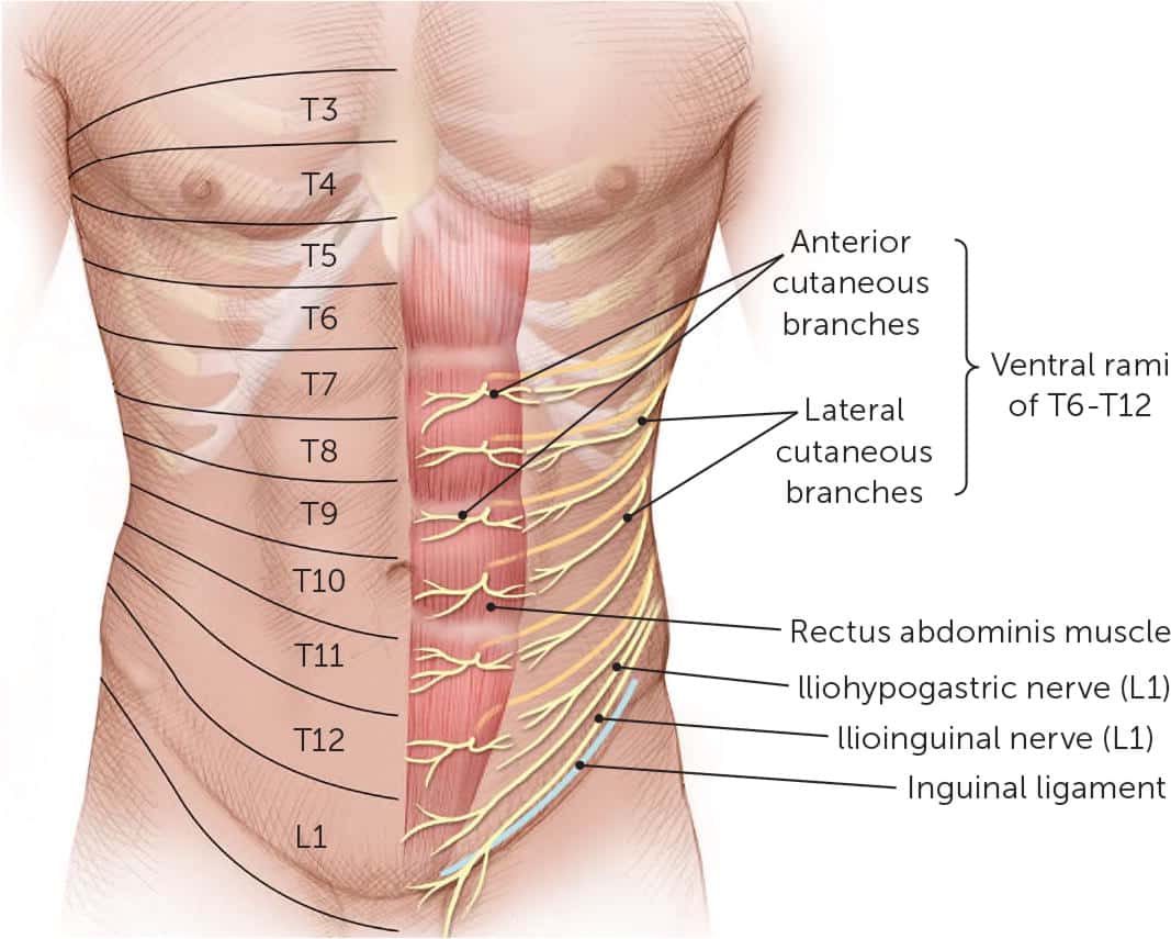 ACNES (Anterior Cutaneous Nerve Entrapment Syndrome) New York NY