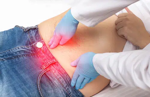 The surgeon performs a finger examination of a patient who has pain around the navel.jpg