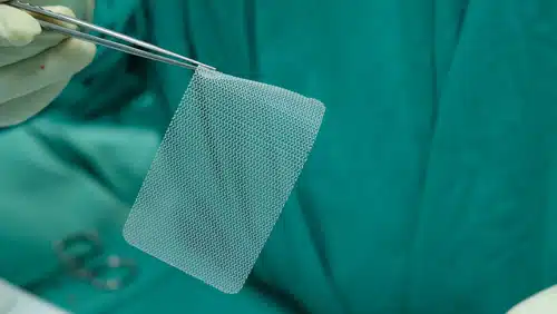 Synthetic Mesh for Inguinal Hernia Repair. Synthetic Mesh for Inguinal Hernia Repair.jpg